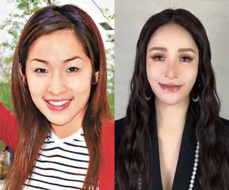 蕭亞軒復出外貌再度「升級」？長下巴巫婆臉嚇壞網民 回顧入行至今整容進化史